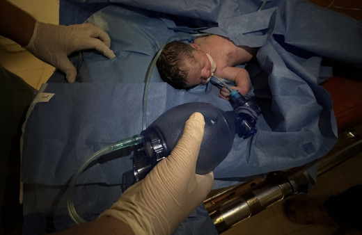 Katliam kan dondurmaya devam ediyor! Saldırıda ölen hamile kadının bebeği kurtarıldı