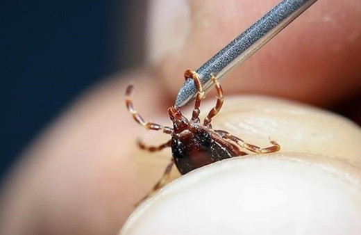 Sivas'ta vücuduna kene yapışan kadın öldü