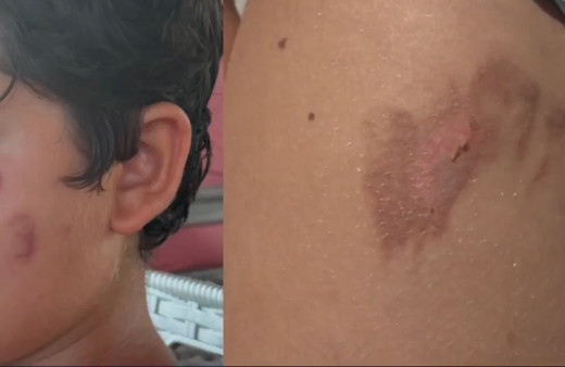 Denize giren korkunç halde çıkıyor! Hastaneler doldu taştı, nedeni belli oldu