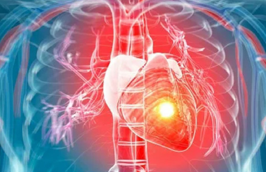 Tropikal fırtınalar sonrası kalp damar hastalıkları şikayetleri arttı