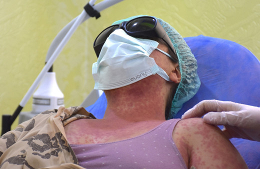 Van'da 4 kişi internet ve aktardan aynı kremi aldı hayatları karardı