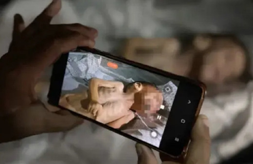 Açlık sınırları zorluyor! 3 Kiloya kadar düşen çocuk yaşamını yitirdi...