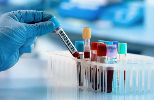 A Rh+ kan gurubuna sahip olanlar dikkat! Yorgunluğun çaresi belli oldu