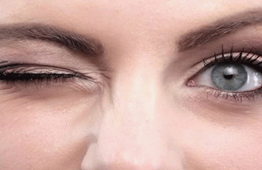 Göz seyirmesi deyip geçmeyin! Asıl sebebi çok başka