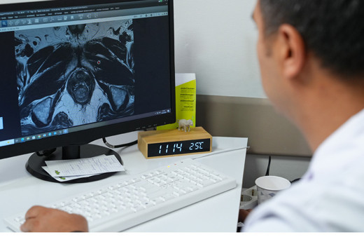 Akıllı biyopsi ile daha doğru tanı, daha etkin tedavi