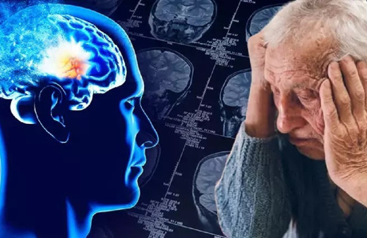 Alzheimer belirtilerine dikkat! Erken tanı hayat kalitesini yükseltiyor...