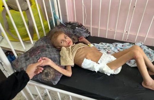 Gazze’de yetersiz beslenme sonucu 12 kiloya düşen 7 yaşındaki May yürüme yetisini kaybetti
