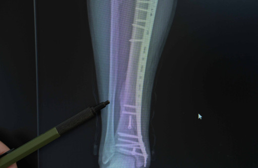 İki teker üzerindeki büyük tehlike