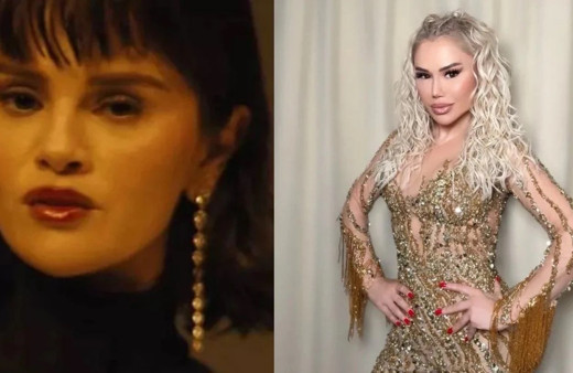 Dünyaca ünlü Selena Gomez estetiği abarttı! Şarkıcı Ceylan'a benzetildi...