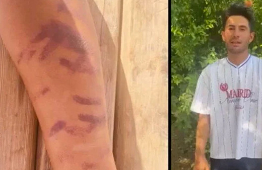 Yeni getirdikleri cihazı denemişler! Kürşat'ın başına gelen çok fena: “Ben yandım başkaları yanmasın"