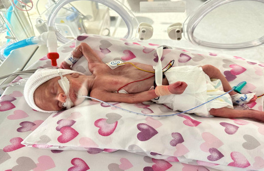 Dünya Prematüre Günü'nde minik Asil Ata'nın mucizevi yolculuğu! 600 gramlık mucize...