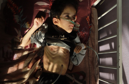 Gazze'de açlık can alıyor! Filistinli çocuklar yaşam mücadelesi veriyor