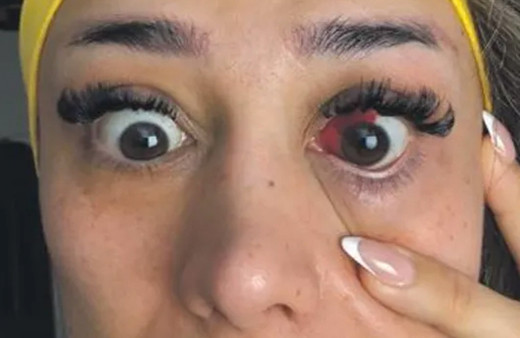 Fitness eğitmeni tavuk döner yedi! Gözü bu hale geldi