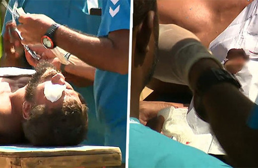 Survivor'ın ünlü ismine doktor müdahalesi!