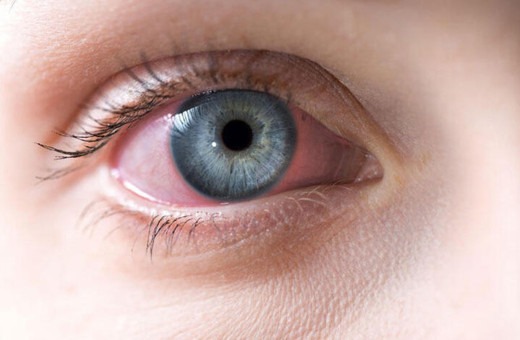 Koronavirüsün hiç bilinmeyen bir belirtisi keşfedildi gözden anlarsınız