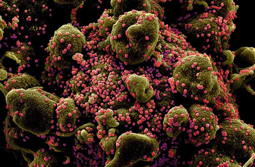 Koronavirüsün insan hücrelerinde yayılışı görüntülendi! Bu ne hız böyle