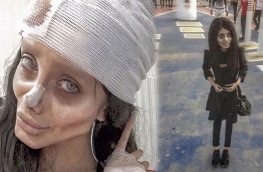 O da koronavirüse yakalandı Angelina Jolie'ye benzemek istiyordu!