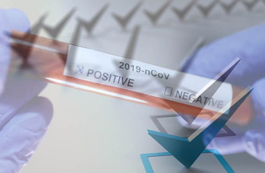 Dikkat çeken koronavirüs anketi! Normalleşme sürecinde yüzde 55’lik kesim o yerlere gitmeyecek