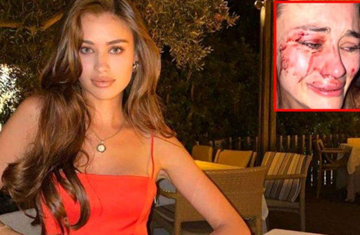 Ünlü modeli sevgilisi mi dövdü? İşte sürpriz tanığın ifadesi