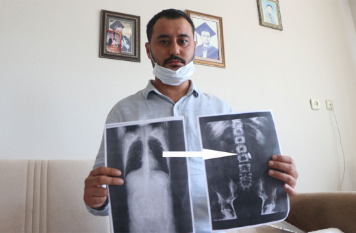 15 Temmuz gazisi 4 yıldır vücudunda hainlerin sıktığı mermiyle yaşıyor