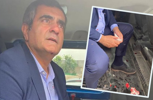 CHP'li Özgür Özel: Şanlıurfa'da milletvekilimiz Ali Şeker ve müşahitlerimiz dövüldü! Kanlı fotoğraf