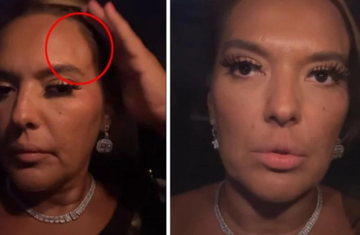 Demet Akalın tekne kazası geçirdi: Nasıl sağ çıktık algılayamıyorum!