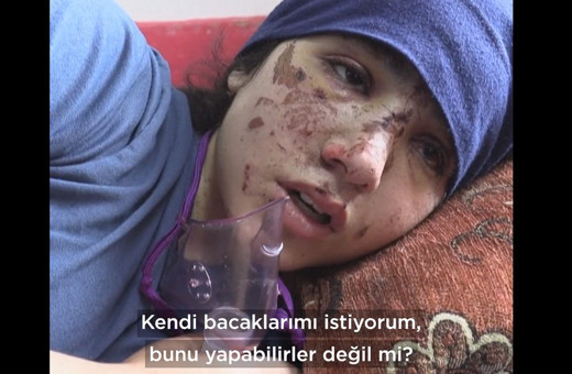 İki bacağını kaybeden Gazzeli kız yürek sızlattı! 'Gelecek diye bir şey yok'