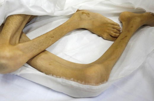 Gazze'de bir çocuk daha açlıktan hayatını kaybetti açlıktan ölenlerin sayısı 37 oldu