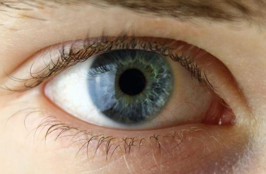 Erken tedavi edilmeyen zona hastalığı görme kaybına sebep olabiliyor