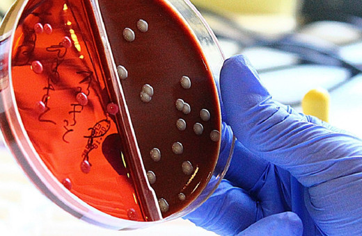 İtalya'da korkutan tablo! Batı Nil Virüsü vakaları artıyor...