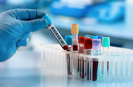 A Rh+ kan gurubuna sahip olanlar dikkat! Yorgunluğun çaresi belli oldu