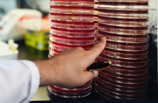 Uzayda göz sağlığına Türk katkısı!