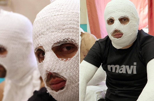 Erzurum'da görülmemiş olay! Araçtaki çakmak tüpü patladı, 2 yaralı