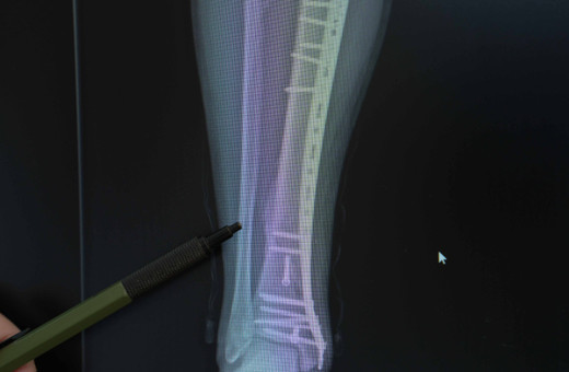 İki teker üzerindeki büyük tehlike