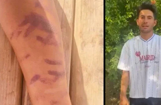 Yeni getirdikleri cihazı denemişler! Kürşat'ın başına gelen çok fena: “Ben yandım başkaları yanmasın"