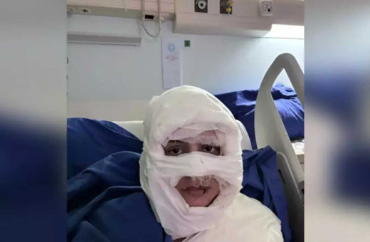 Korkunç olay! Genç kadını kolonya döküp ateşe verdi, tutuklandı