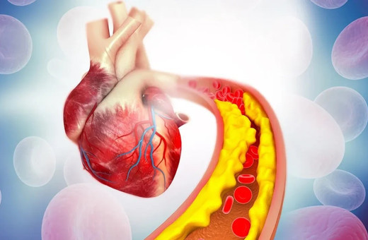 Kalp sağlığınız tehlike altında! Kötü kolestrol tetikliyor...