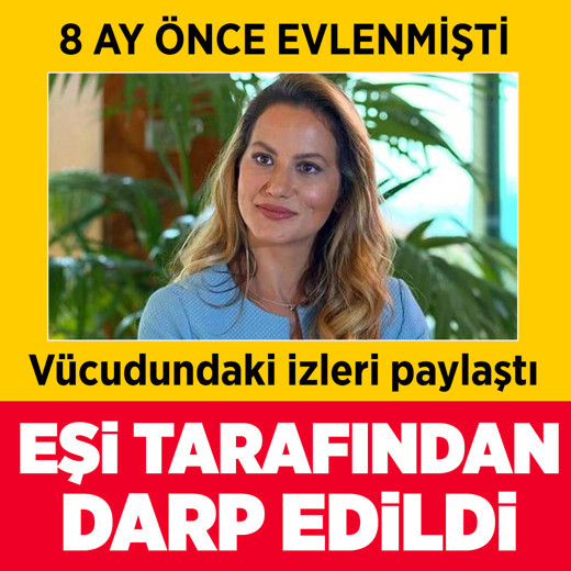 8 ay önce evlenmişti! Yıldız Asyalı eşi tarafından darp edildi fotoğraf paylaştı