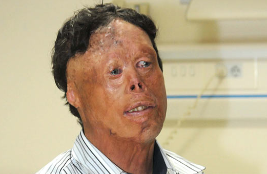 Nakilden sonra ilk kez basının karşısında - Resim: 1