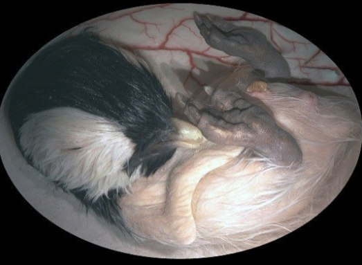 Anne karnında böyle görüntülendiler - Resim: 4