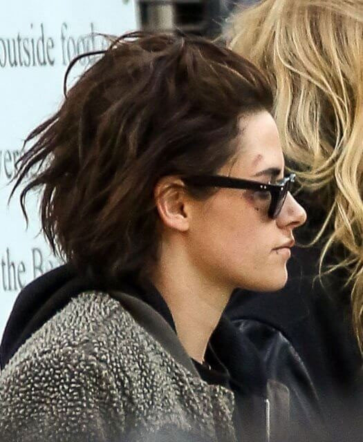 Dünyaca ünlü yıldız içler acısı halde şiddet mi gördü - Resim: 1