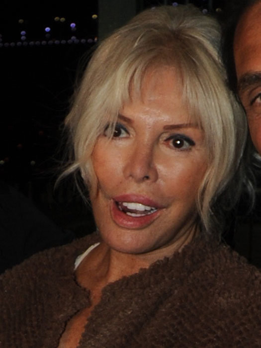 Dişsiz Süperstar Ajda Pekkan.. - Resim: 2