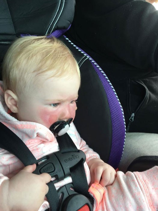 Minicik bebek bu hale geldi tehlike büyük! - Resim: 2