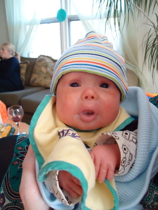 Dünya bu bebeği konuşuyor gelmiş geçmiş en garip hastalık! - Resim: 4