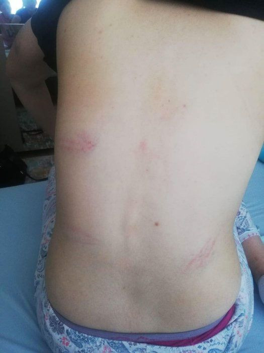 Genç kadını kaçırdıkları rezidansta çırılçıplak soyup videoya aldılar yüzünde sigara söndürdüler - Resim: 4