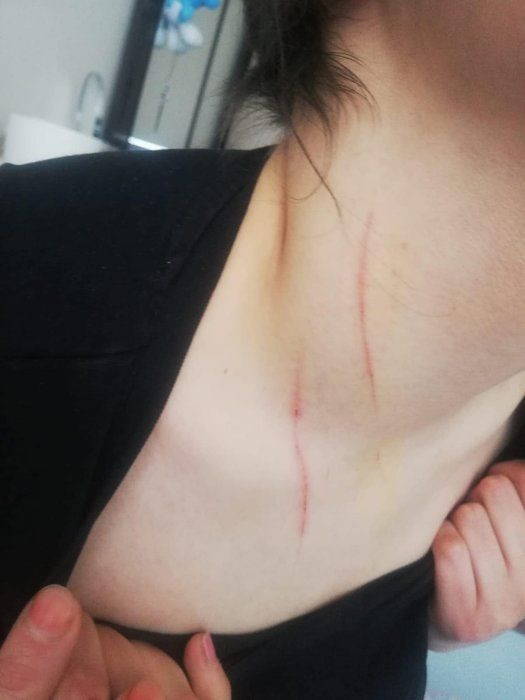 Lüks rezidansta kadınlardan kadınlara zincirleme taciz ve işkence! Çırıçıplak soyup, üzerinde sigara... - Resim: 4