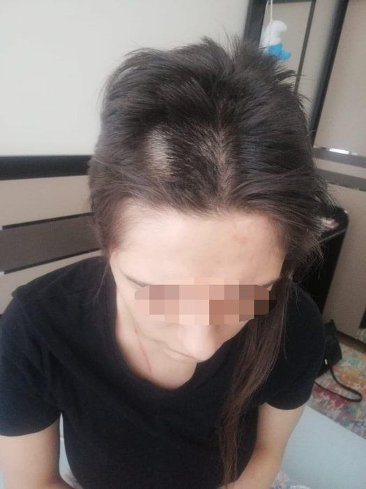 Lüks rezidansta kadınlardan kadınlara zincirleme taciz ve işkence! Çırıçıplak soyup, üzerinde sigara... - Resim: 2