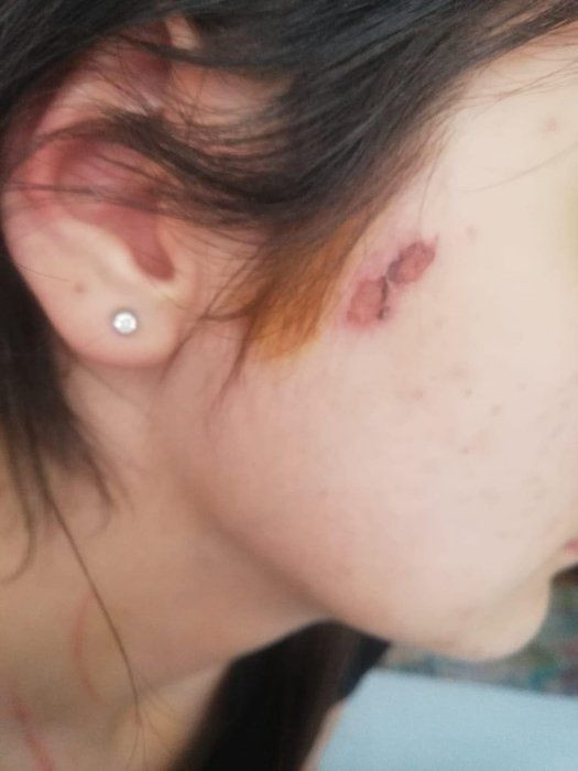 Rezidansta kadınlara işkence Adli Tıp raporunda! Okuyanın kanı donuyor... - Resim: 4