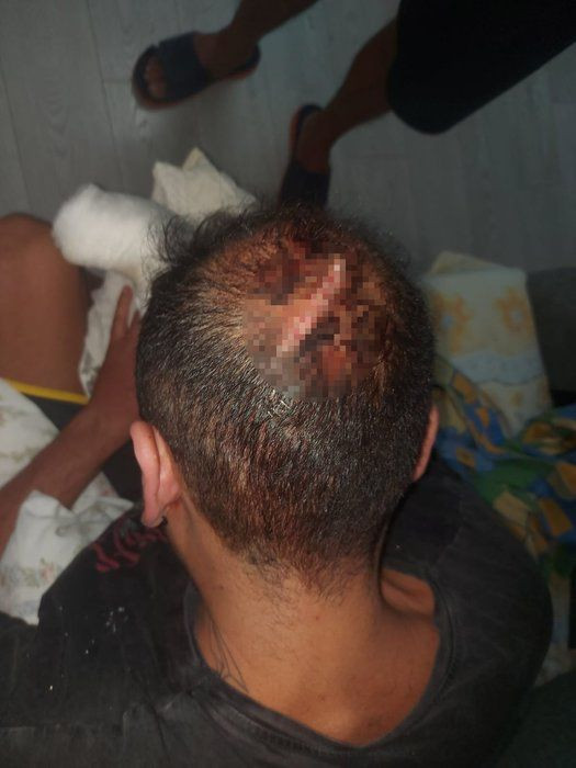 Asmalı Mescit'te dehşet! Dövme sanatçısını çivili sopalarla dövdüler - Resim: 2