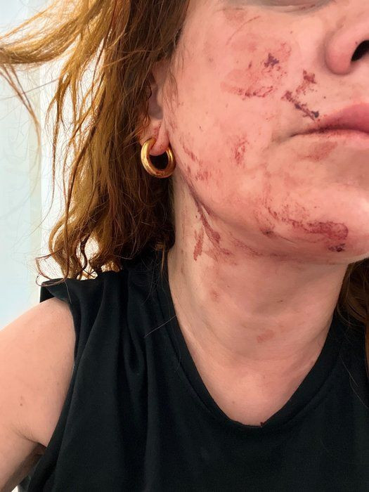 Asmalı Mescit'te dehşet! Dövme sanatçısını çivili sopalarla dövdüler - Resim: 3